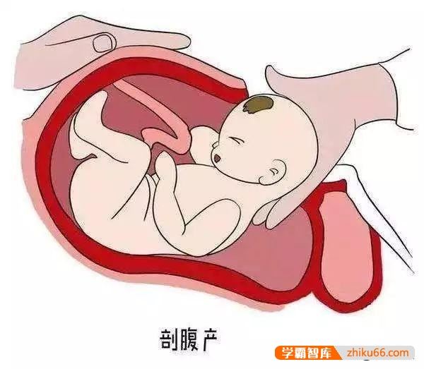 剖腹产以后再怀孕能自然分娩吗？